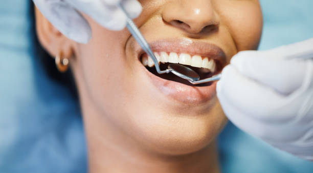 Best Emergency Treatment for Dental Infections or Abscesses in Montpelier, OH